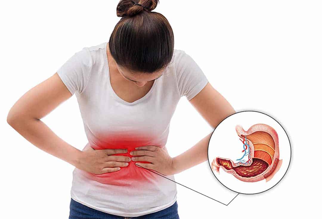 Hình ảnh đau dạ dày
