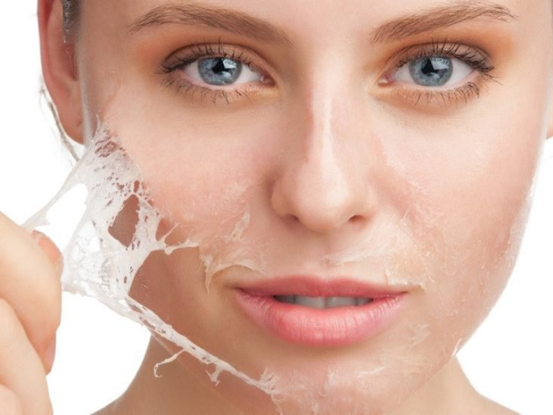 Peel da bong tróc không còn là xu hướng Peel da bong tróc không còn là xu hướng
