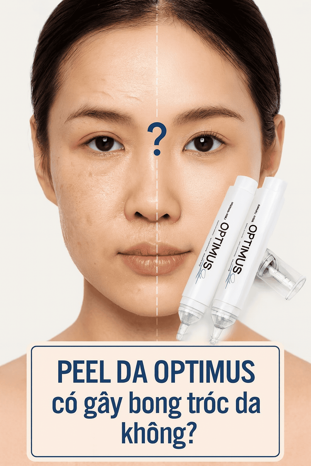 Peel da Optimus có gây bong tróc da không? Peel da Optimus có gây bong tróc da không?